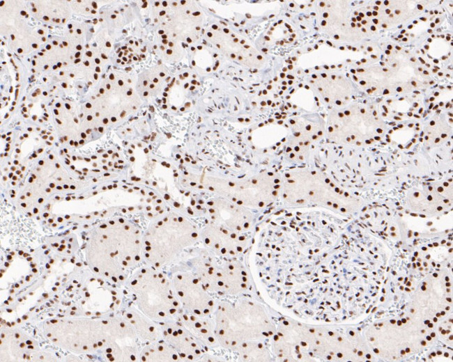 CPSF3 Antibody in Immunohistochemistry (Paraffin) (IHC (P))