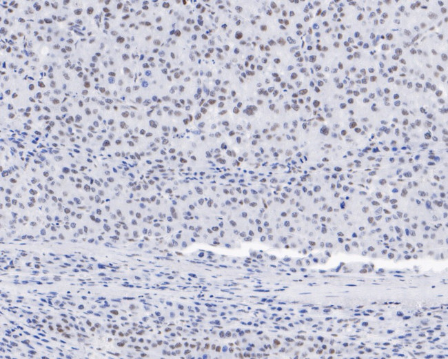 CPSF3 Antibody in Immunohistochemistry (Paraffin) (IHC (P))