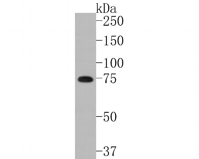 CPSF3 Antibody in Western Blot (WB)