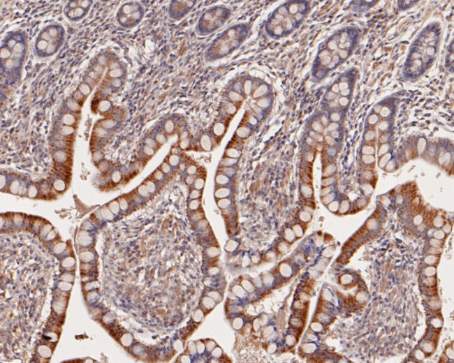 UBE4A Antibody in Immunohistochemistry (Paraffin) (IHC (P))