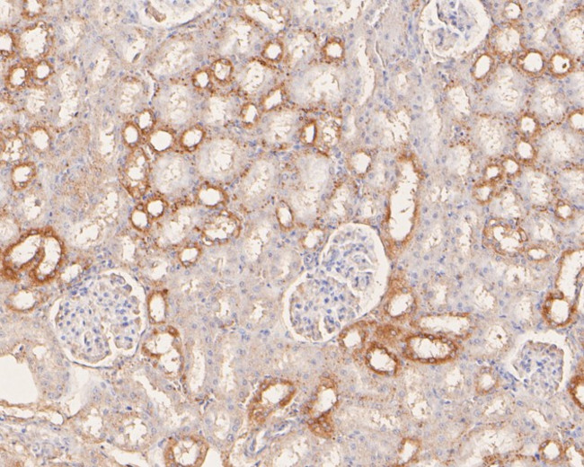 SLC27A4 Antibody in Immunohistochemistry (Paraffin) (IHC (P))