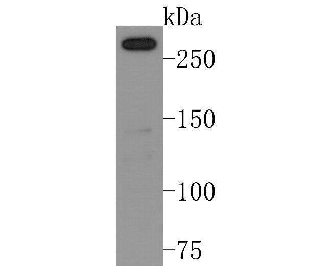 NCoR1 Antibody in Western Blot (WB)