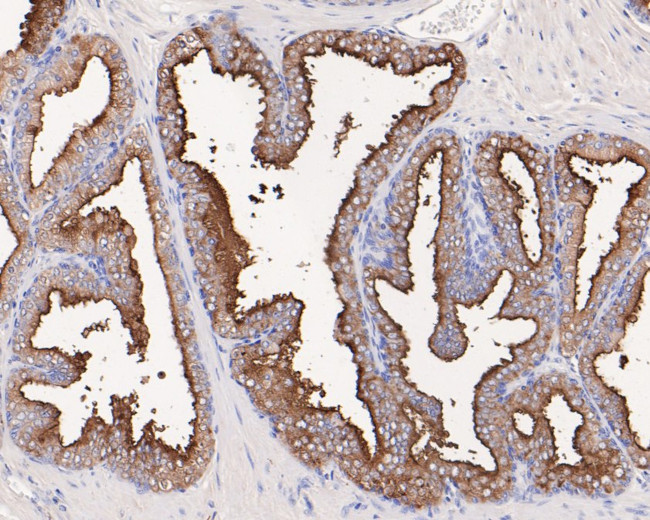 PSMA Antibody in Immunohistochemistry (Paraffin) (IHC (P))