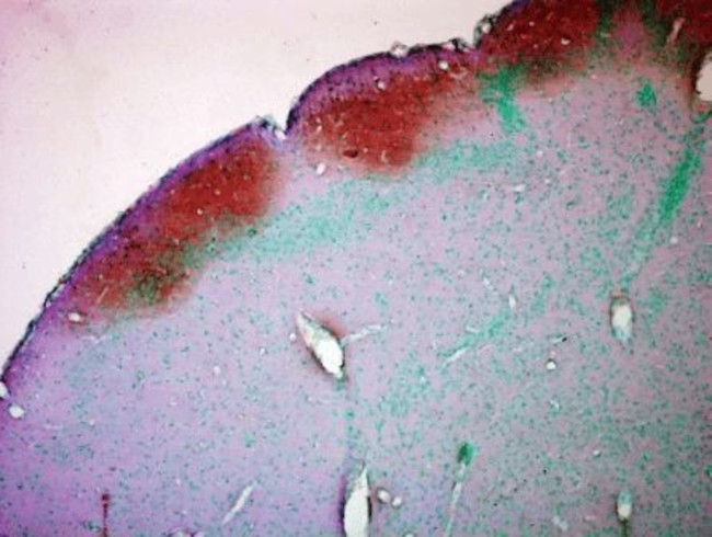 CaMKII alpha/beta Antibody in Immunohistochemistry (PFA fixed) (IHC (PFA))