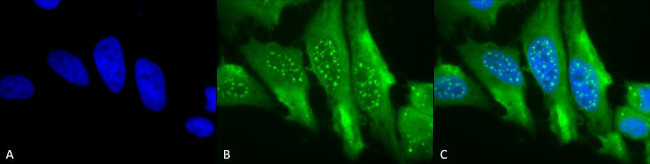 HO-1 Antibody in Immunocytochemistry (ICC/IF)