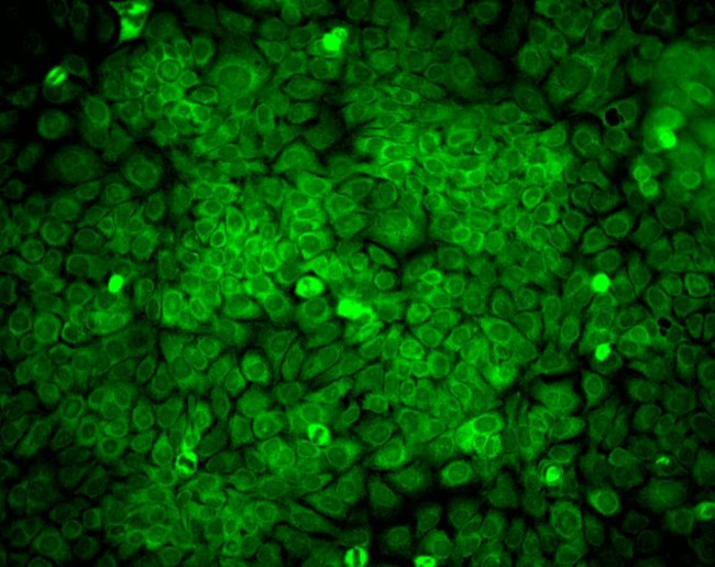 ERp57 Antibody in Immunocytochemistry (ICC/IF)