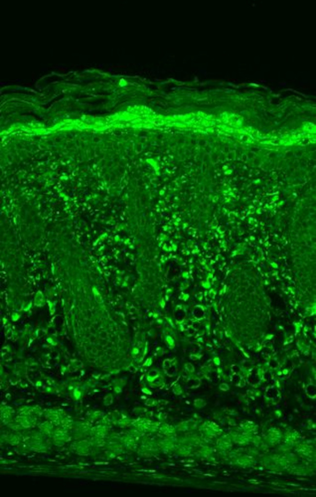 HSPB8 Antibody in Immunohistochemistry (Paraffin) (IHC (P))