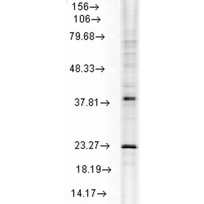 HSPB8 Antibody in Western Blot (WB)