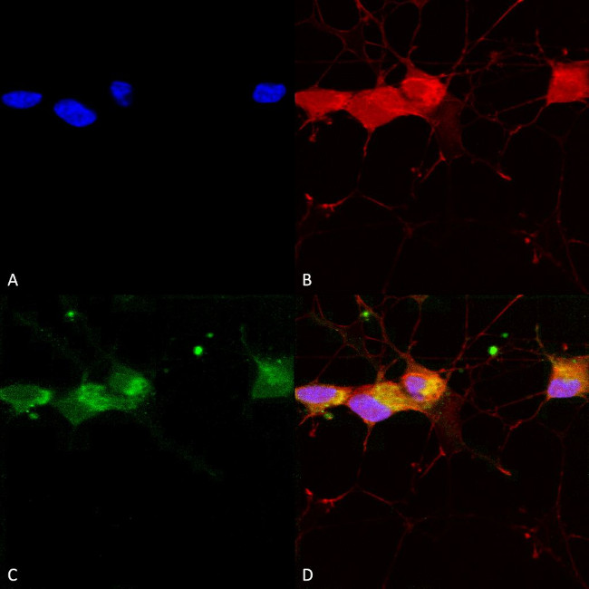 NMDAR2B Antibody in Immunocytochemistry (ICC/IF)