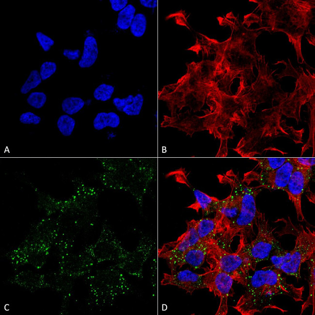 VGLUT3 Antibody in Immunocytochemistry (ICC/IF)