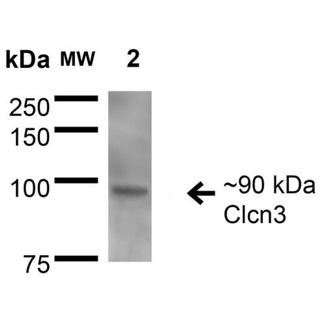 CLCN3 Antibody in Western Blot (WB)
