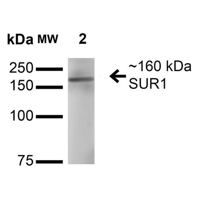 SUR1 Antibody in Western Blot (WB)