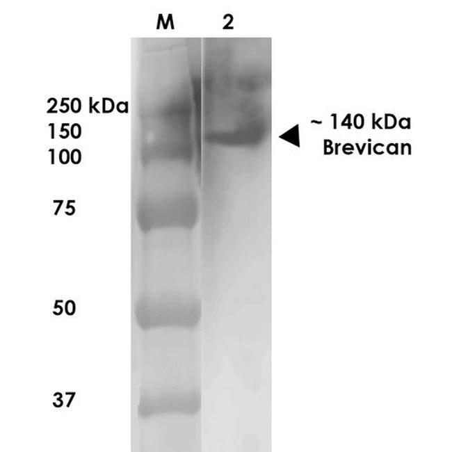 Brevican Antibody in Western Blot (WB)