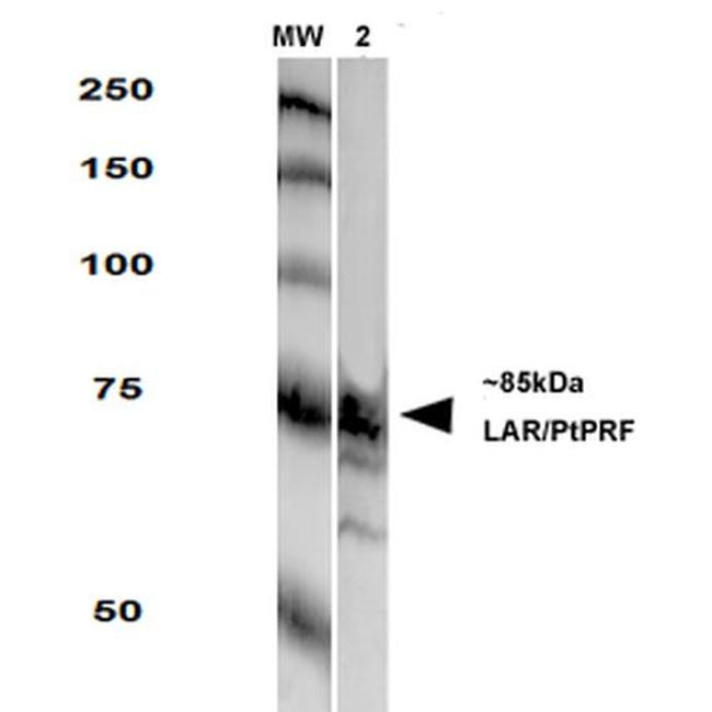 PTPRF Antibody in Western Blot (WB)