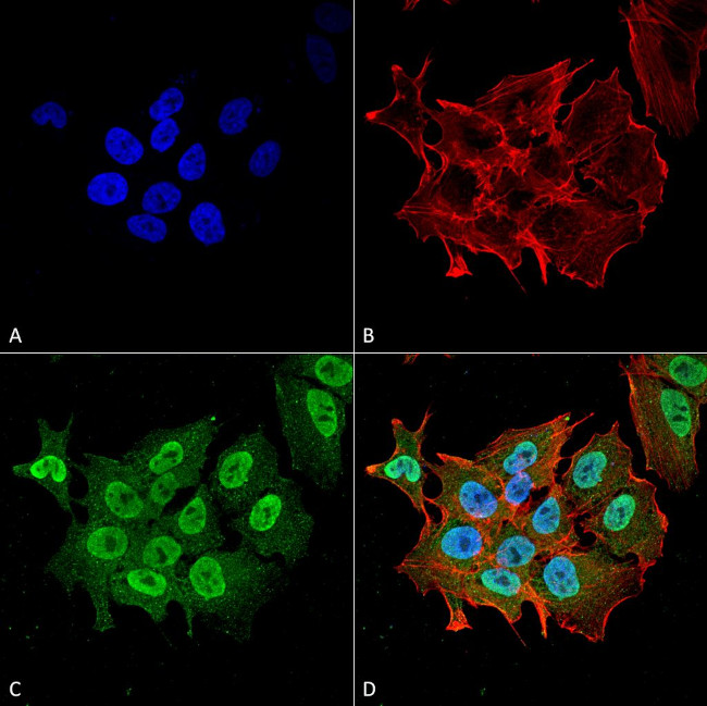 Ataxin 1 Antibody in Immunocytochemistry (ICC/IF)