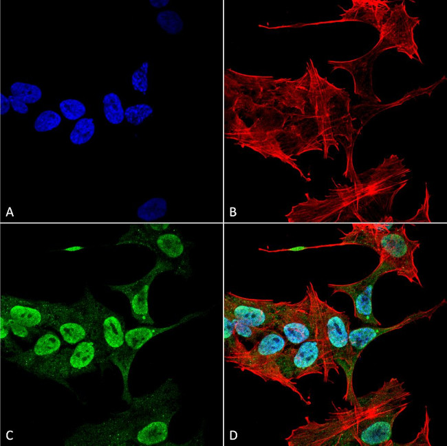 alpha Synuclein Antibody in Immunocytochemistry (ICC/IF)