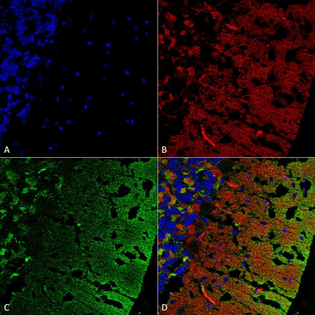 alpha Synuclein Antibody in Immunohistochemistry (Paraffin) (IHC (P))