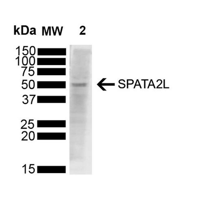 SPATA2L Antibody in Western Blot (WB)