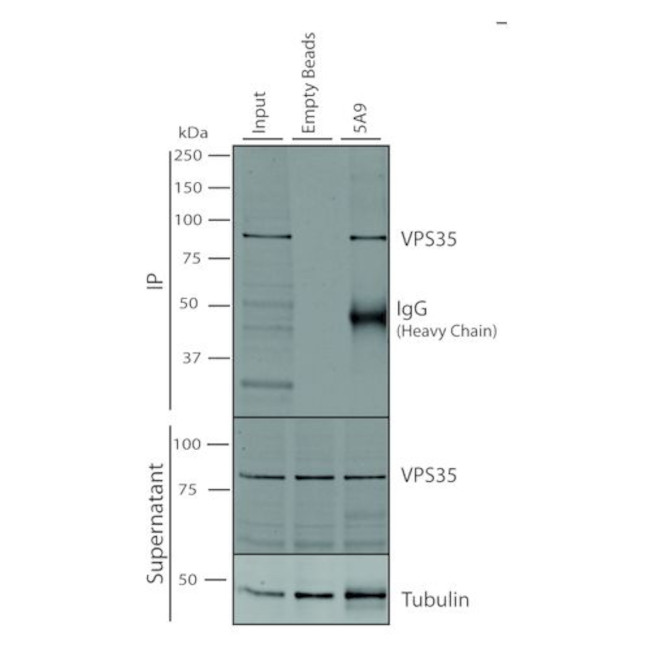 VPS35 Antibody in Immunoprecipitation (IP)