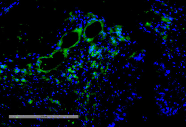 VPS35 Antibody in Immunohistochemistry (IHC)