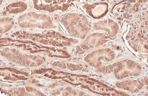 CPT1A Antibody in Immunohistochemistry (Paraffin) (IHC (P))