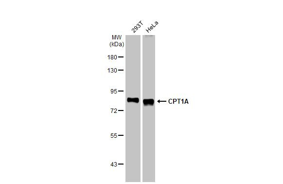 CPT1A Antibody in Western Blot (WB)