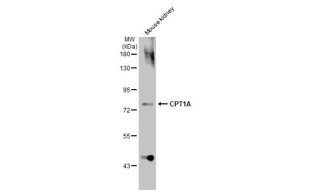 CPT1A Antibody in Western Blot (WB)