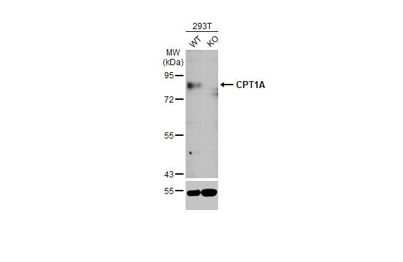 CPT1A Antibody in Western Blot (WB)