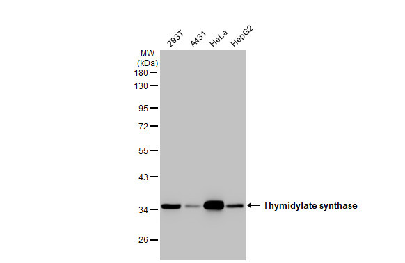 Thymidylate Synthase Antibody in Western Blot (WB)
