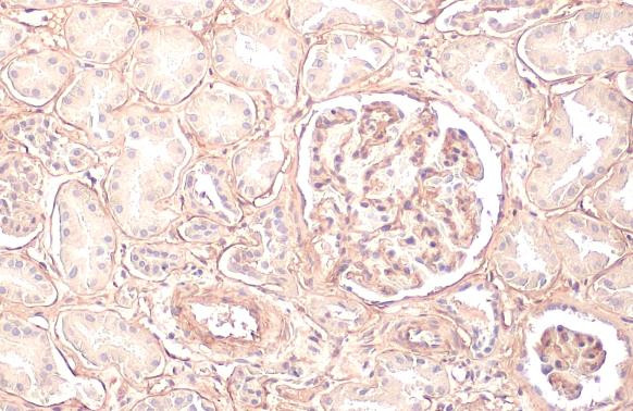 COL4A1 Antibody in Immunohistochemistry (Paraffin) (IHC (P))