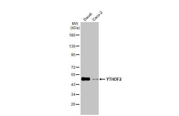 YTHDF2 Antibody in Western Blot (WB)