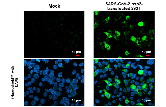 SARS-CoV-2 NSP2 Antibody in Immunocytochemistry (ICC/IF)