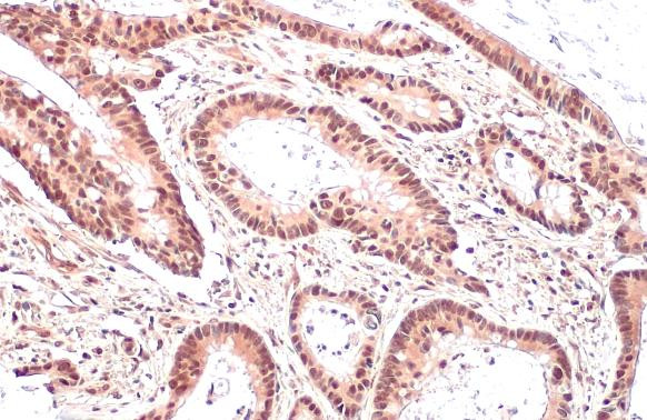 MRE11 Antibody in Immunohistochemistry (Paraffin) (IHC (P))