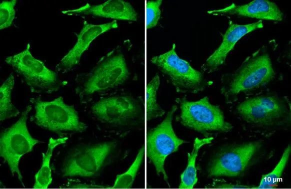 PI3K p85 alpha Antibody in Immunocytochemistry (ICC/IF)