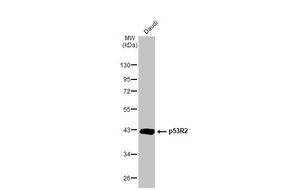 p53R2 Antibody in Western Blot (WB)