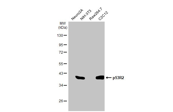 p53R2 Antibody in Western Blot (WB)