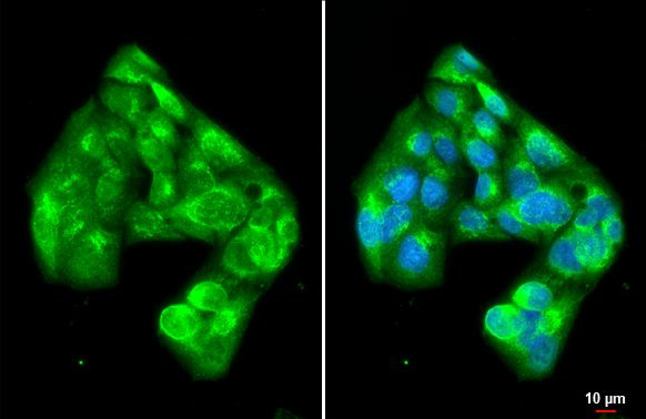 PI3K p85 alpha Antibody in Immunocytochemistry (ICC/IF)