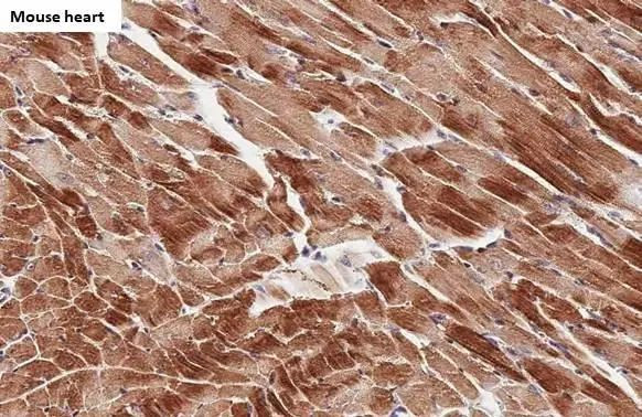 Cardiac Troponin I Antibody in Immunohistochemistry (Paraffin) (IHC (P))