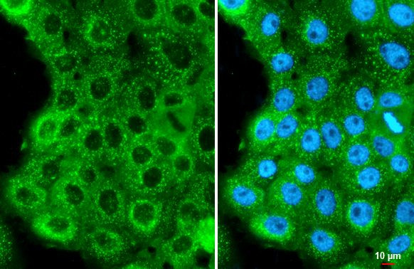 HPV Type 16 E7 Antibody in Immunocytochemistry (ICC/IF)