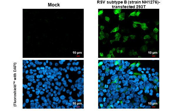 RSV Type B Glycoprotein G Antibody in Immunocytochemistry (ICC/IF)