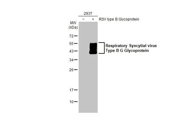 RSV Type B Glycoprotein G Antibody in Western Blot (WB)