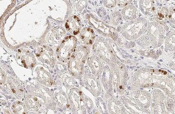 Epo Antibody in Immunohistochemistry (Paraffin) (IHC (P))