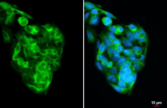 Transthyretin Antibody in Immunocytochemistry (ICC/IF)