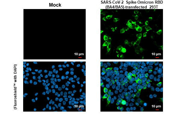 SARS-CoV-2 Spike Protein RBD Omicron Antibody in Immunocytochemistry (ICC/IF)