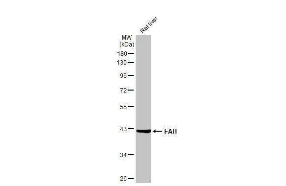 FAH Antibody in Western Blot (WB)