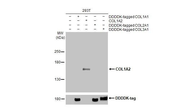 COL1A2 Antibody in Western Blot (WB)