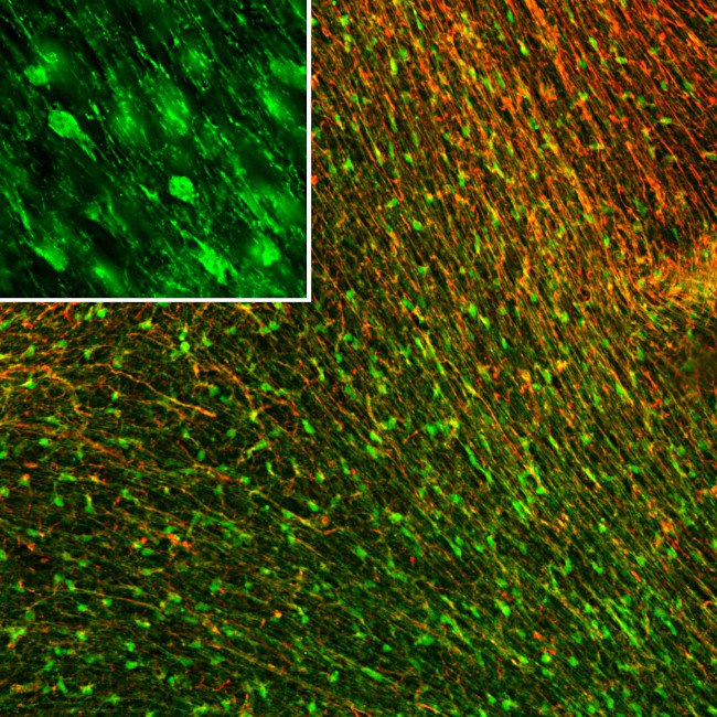 FABP7 Antibody in Immunohistochemistry (IHC)