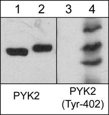 Phospho-PYK2 (Tyr402) Antibody in Western Blot (WB)