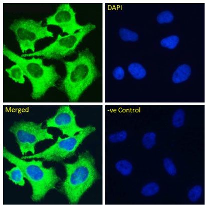 Volociximab Chimeric Antibody in Immunocytochemistry (ICC/IF)