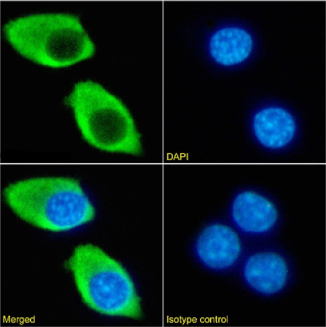 CD122 Chimeric Antibody in Immunocytochemistry (ICC/IF)